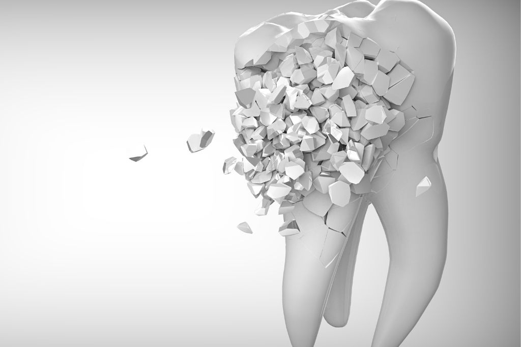 Mercury-Free Dentistry