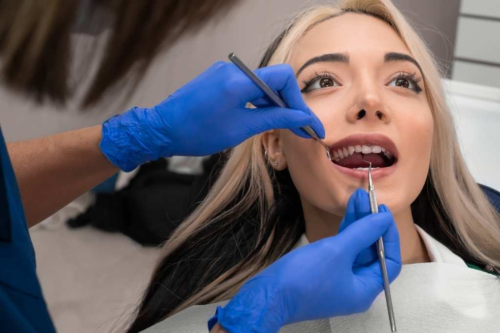 Dental Fillings in North York