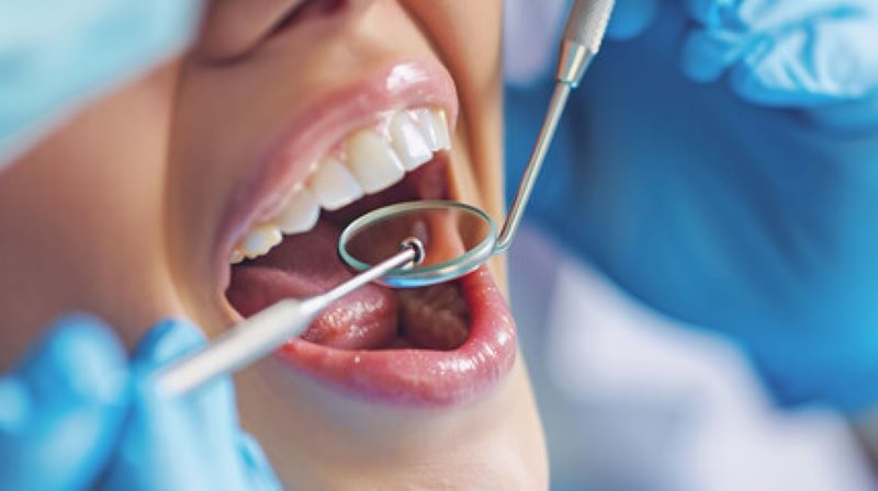 Dental Fillings Near You