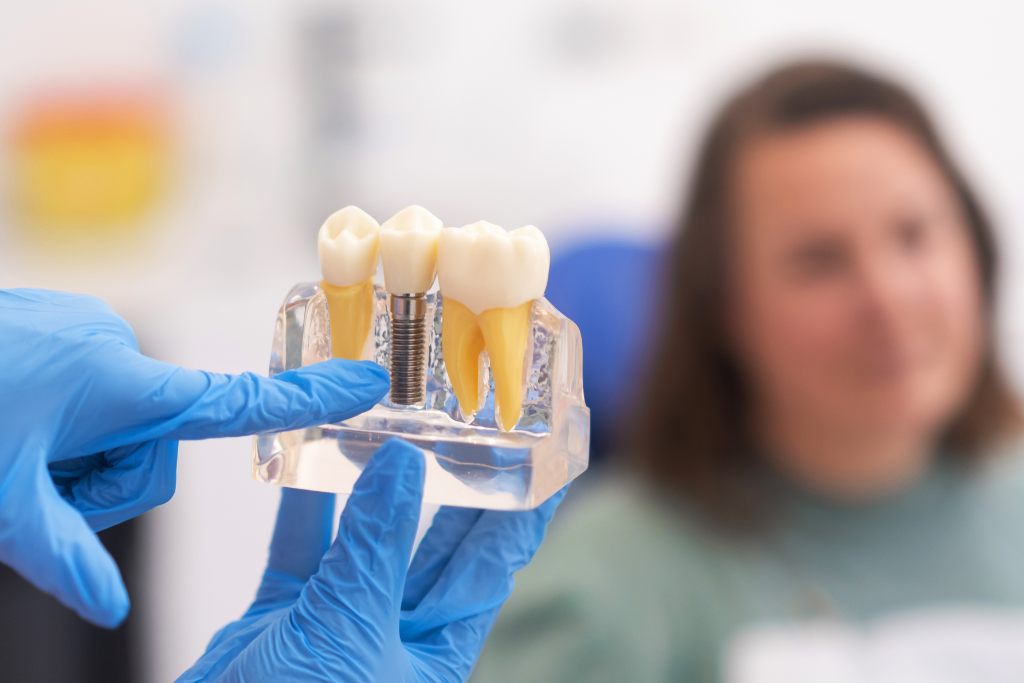 Dental Implants Near You